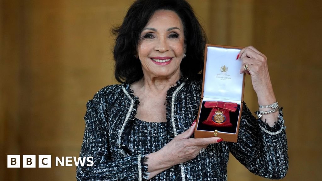 Dame Shirley Bassey won’t reply to fan mail after hand surgery